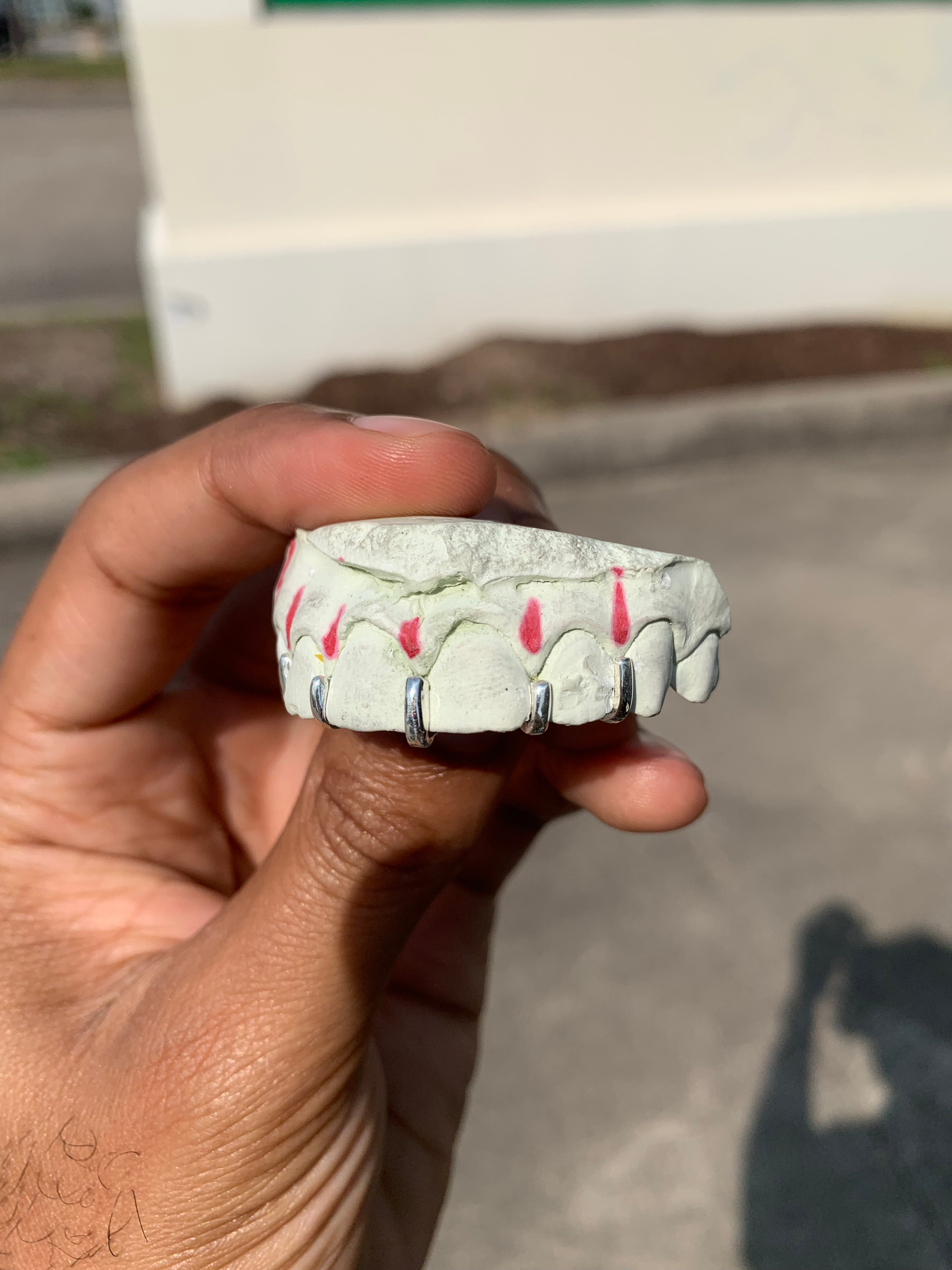 Gap Grillz with 5 Spaces